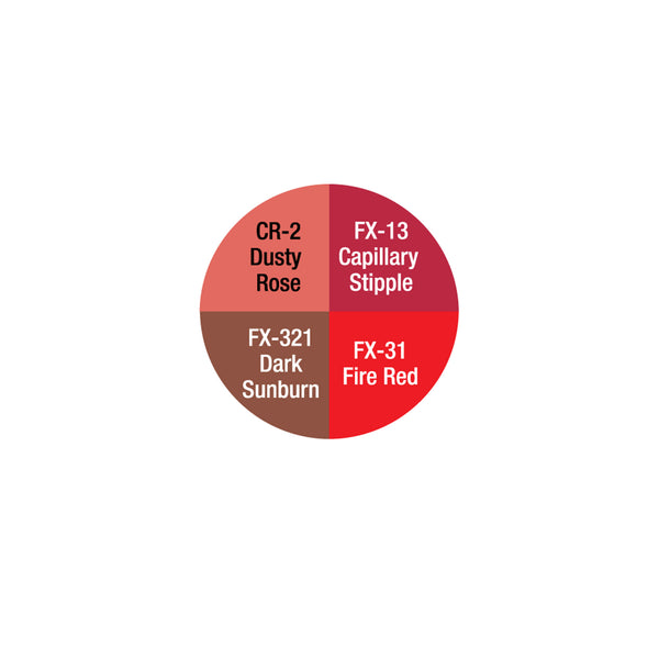 SEVERE EXPOSURE WHEEL - CK9